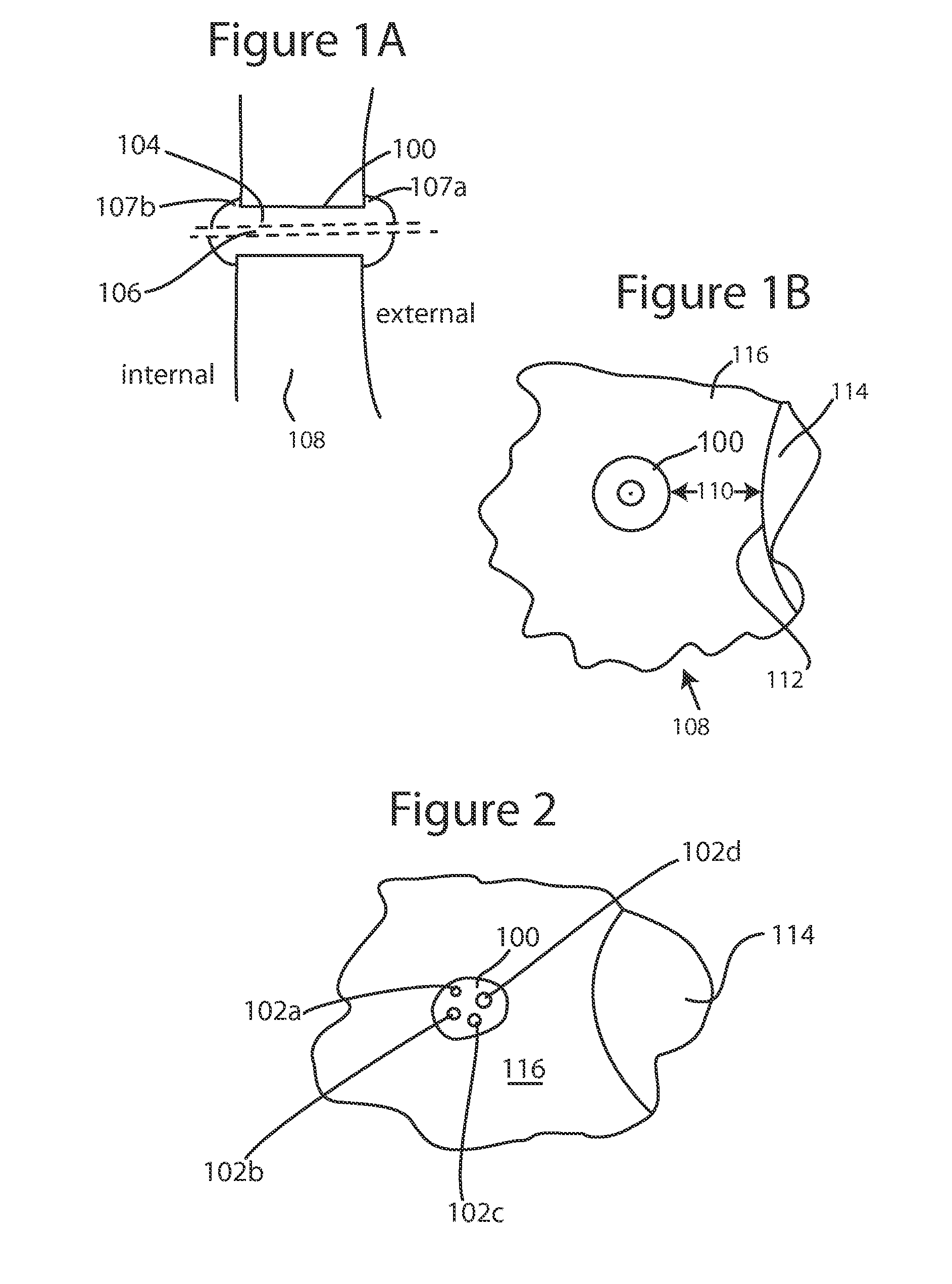 Glaucoma drainage device and uses thereof