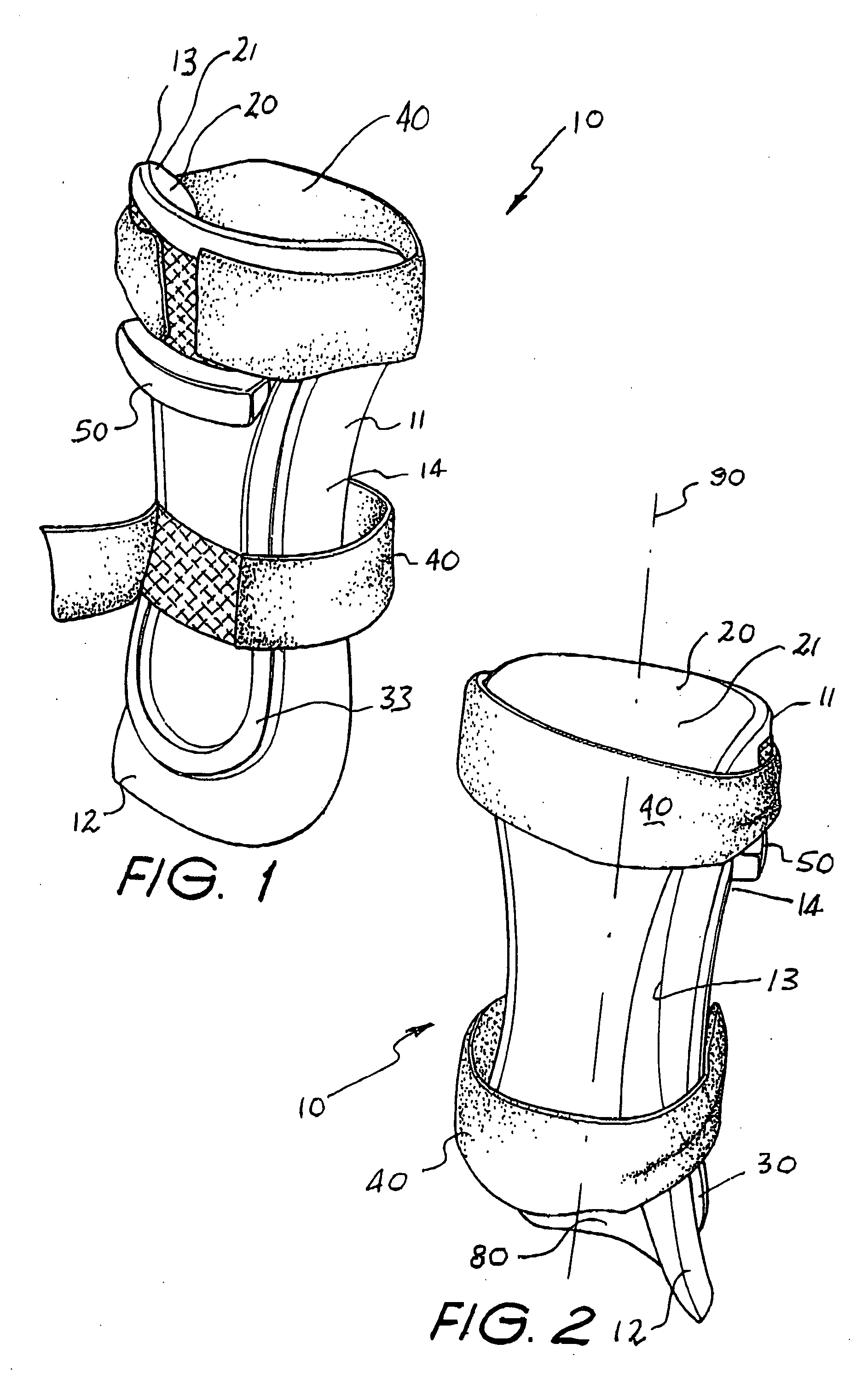 Pressure ulcer prosthesis and method for treating and/or preventing pressure ulcers