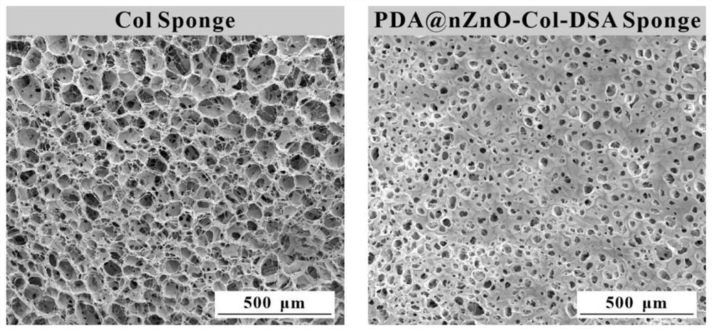 Nano-zinc oxide/collagen-based antibacterial dressing and preparation method thereof