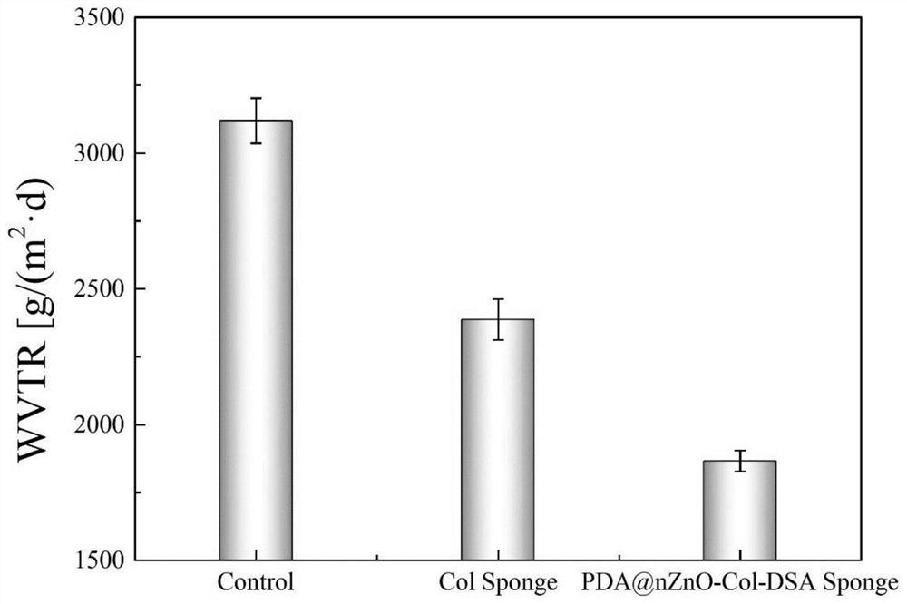 Nano-zinc oxide/collagen-based antibacterial dressing and preparation method thereof