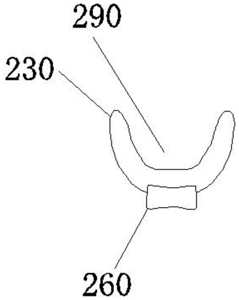 Denture secondary fine restoration method