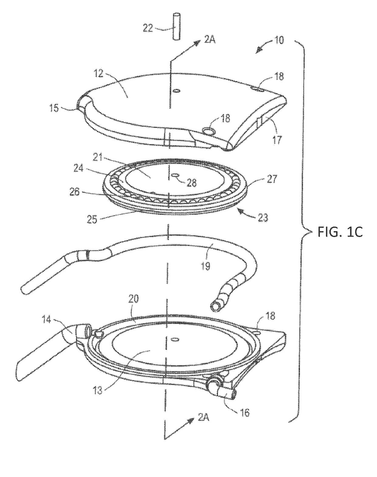 Apparatus and methods for treating excess intraocular fluid