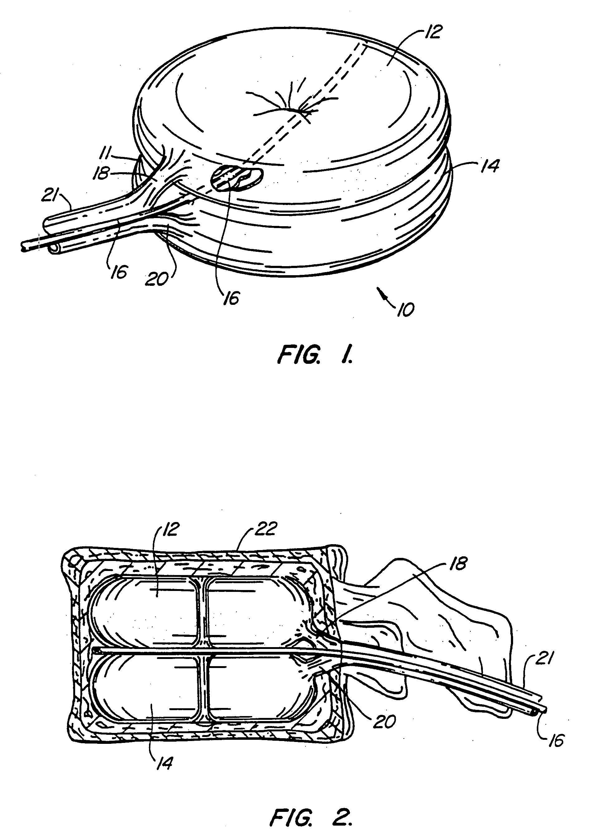 Inflatable device for use in surgical protocol relating to fixation of bone