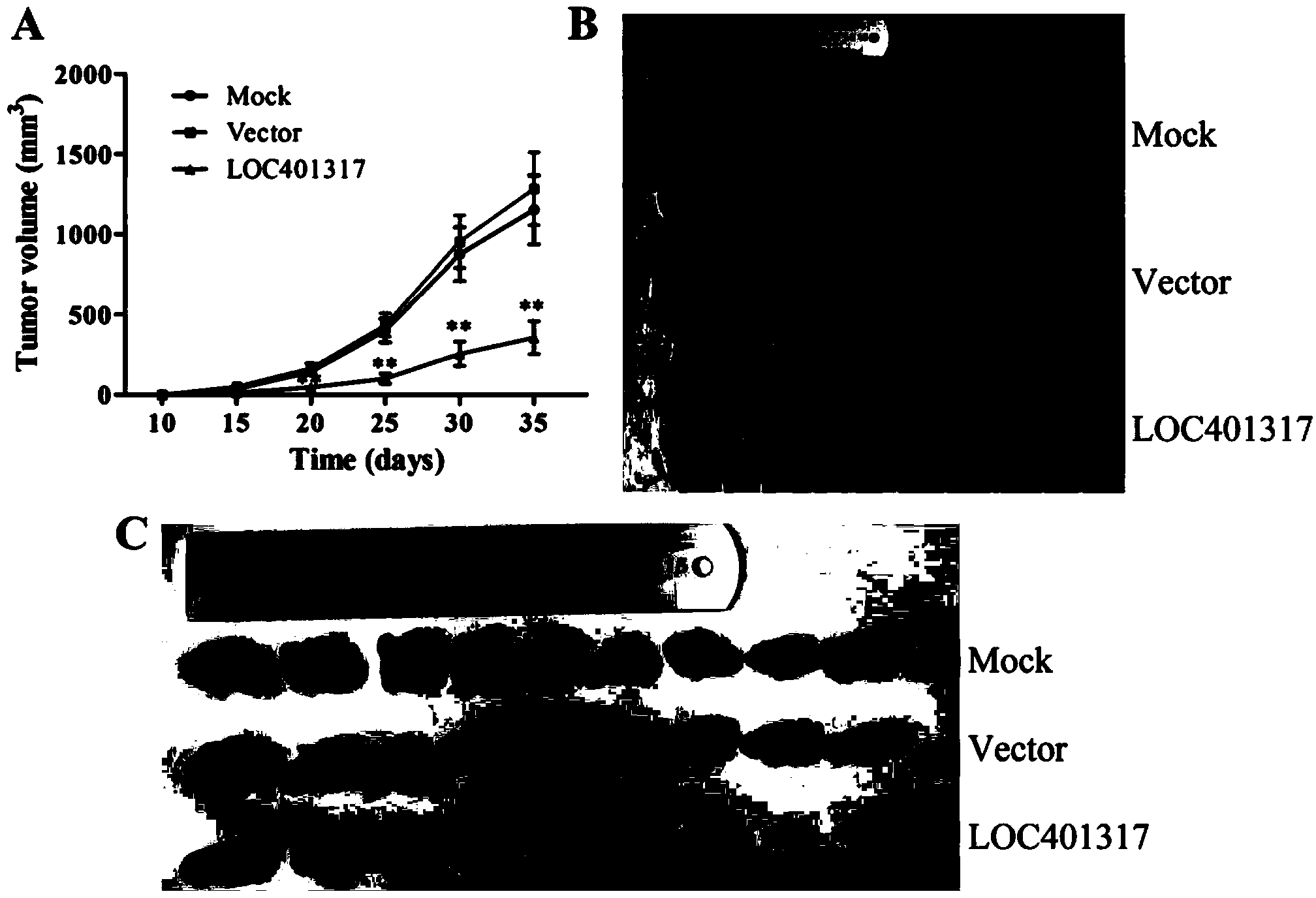 In situ hybridization probe, reagent and application of long non-coding RNA LOC401317