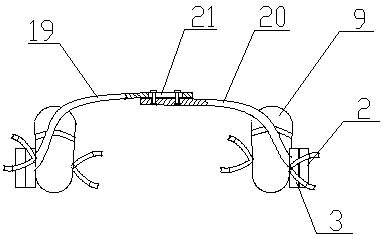 Splay foot orthosis