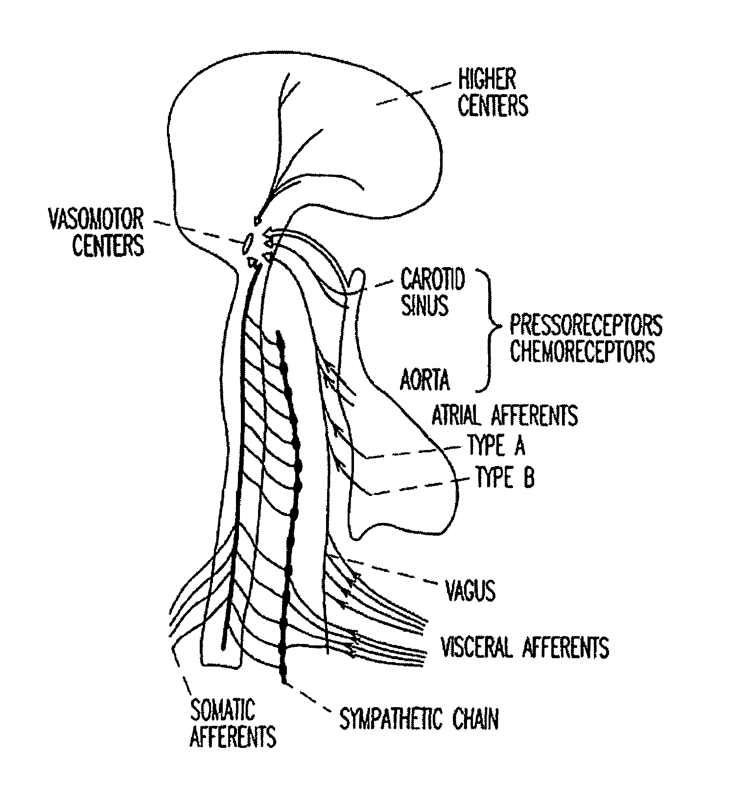 Adaptive baroreflex stimulation therapy for disordered breathing