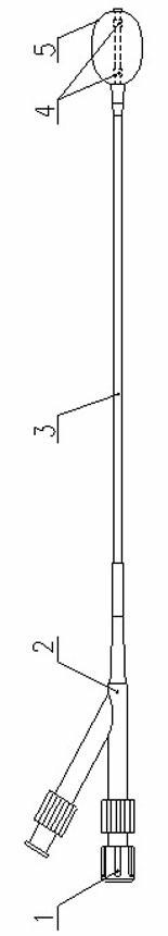 Vertebral oriented dilated balloon catheter