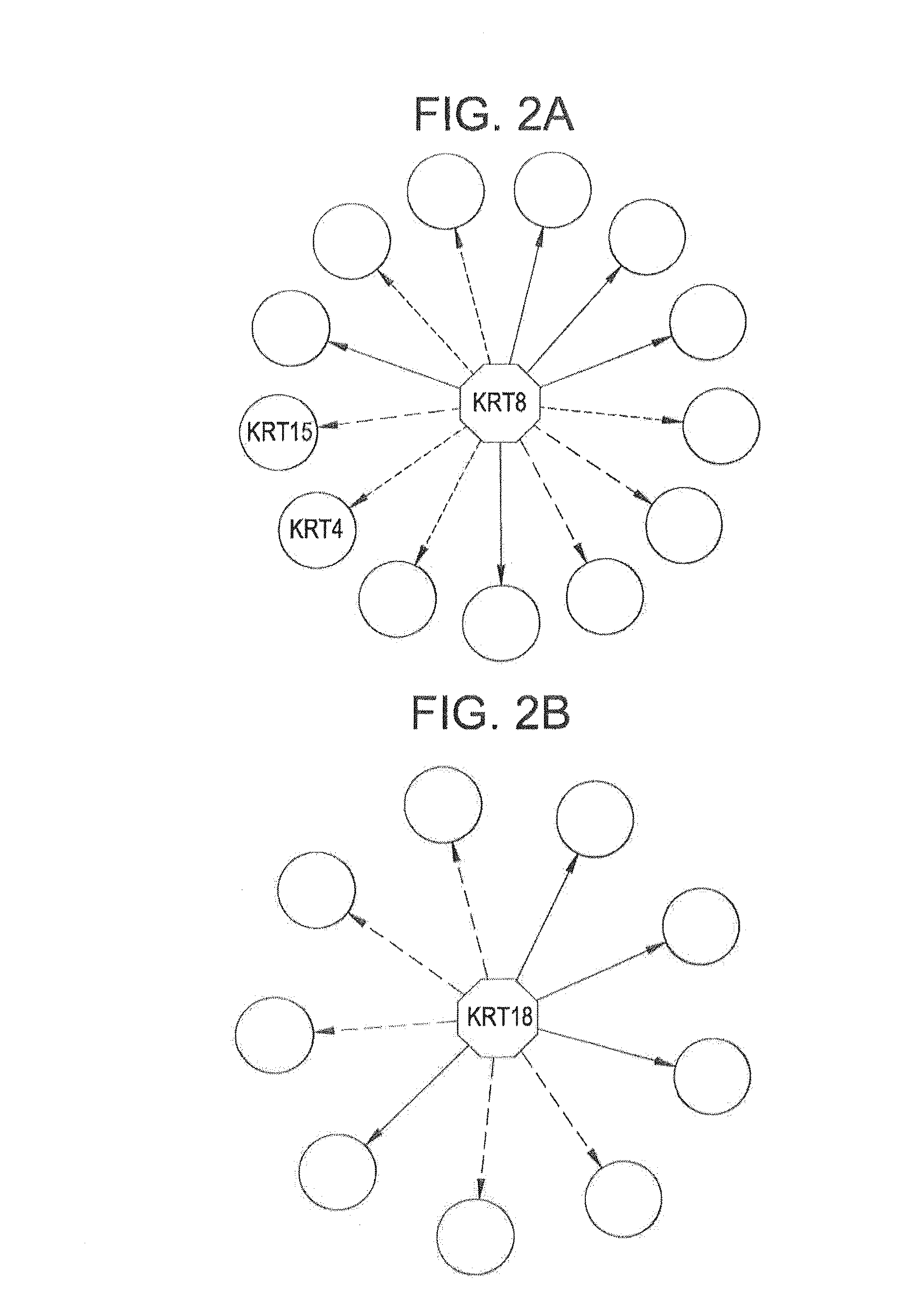 Use of markers including filamin a in the diagnosis and treatment of prostate cancer