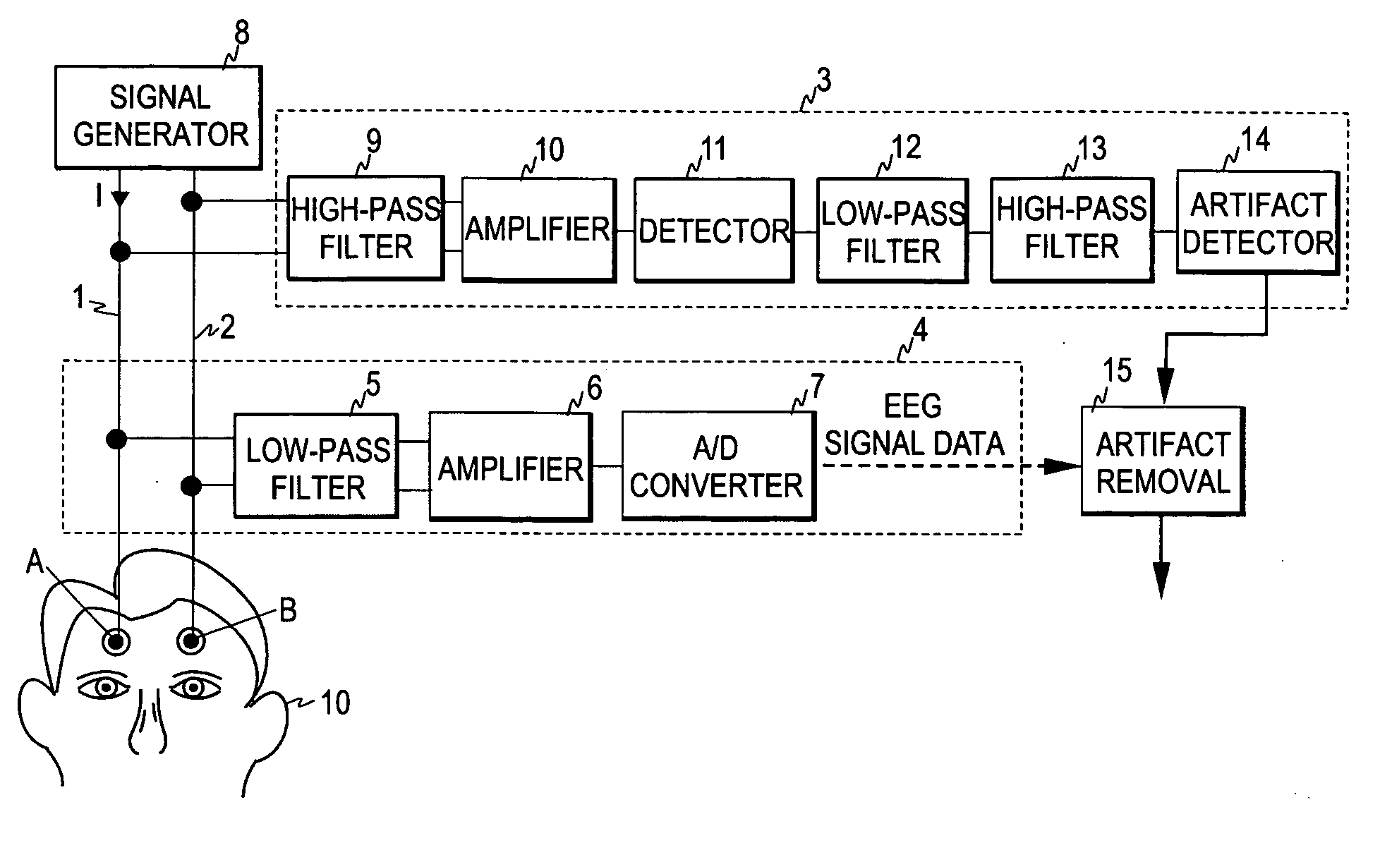 Detection of artifacts in bioelectric signals