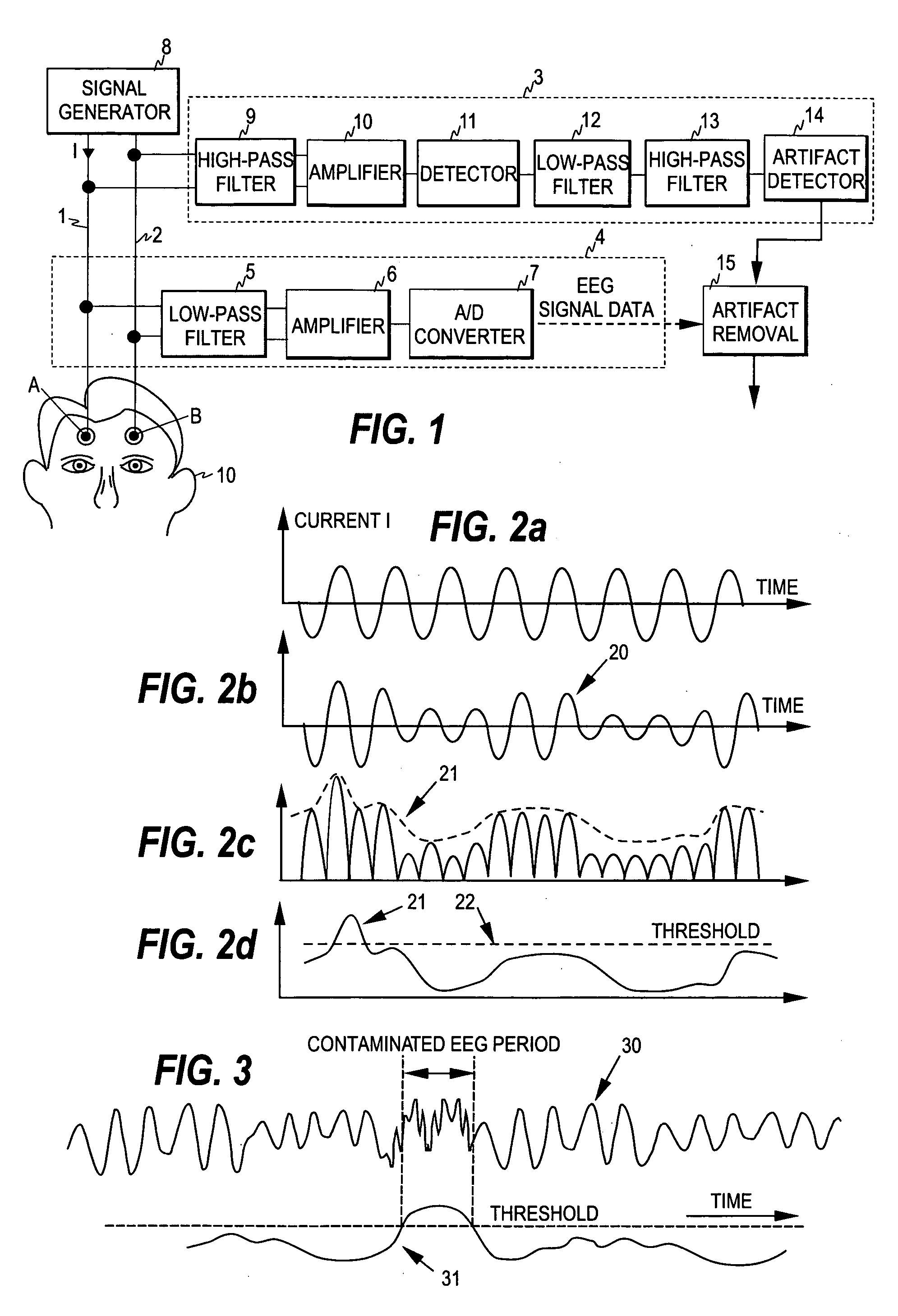 Detection of artifacts in bioelectric signals