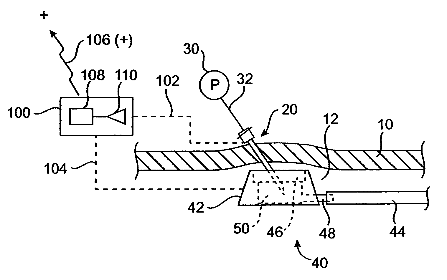 Vascular access port with needle detector