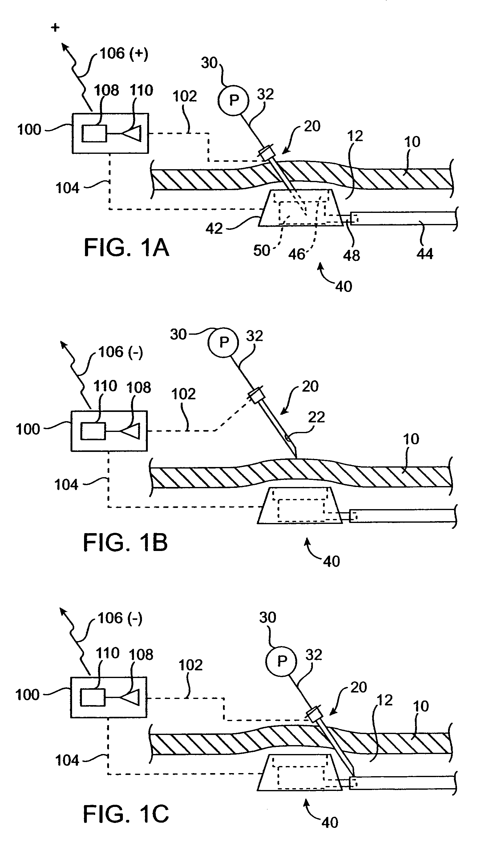 Vascular access port with needle detector