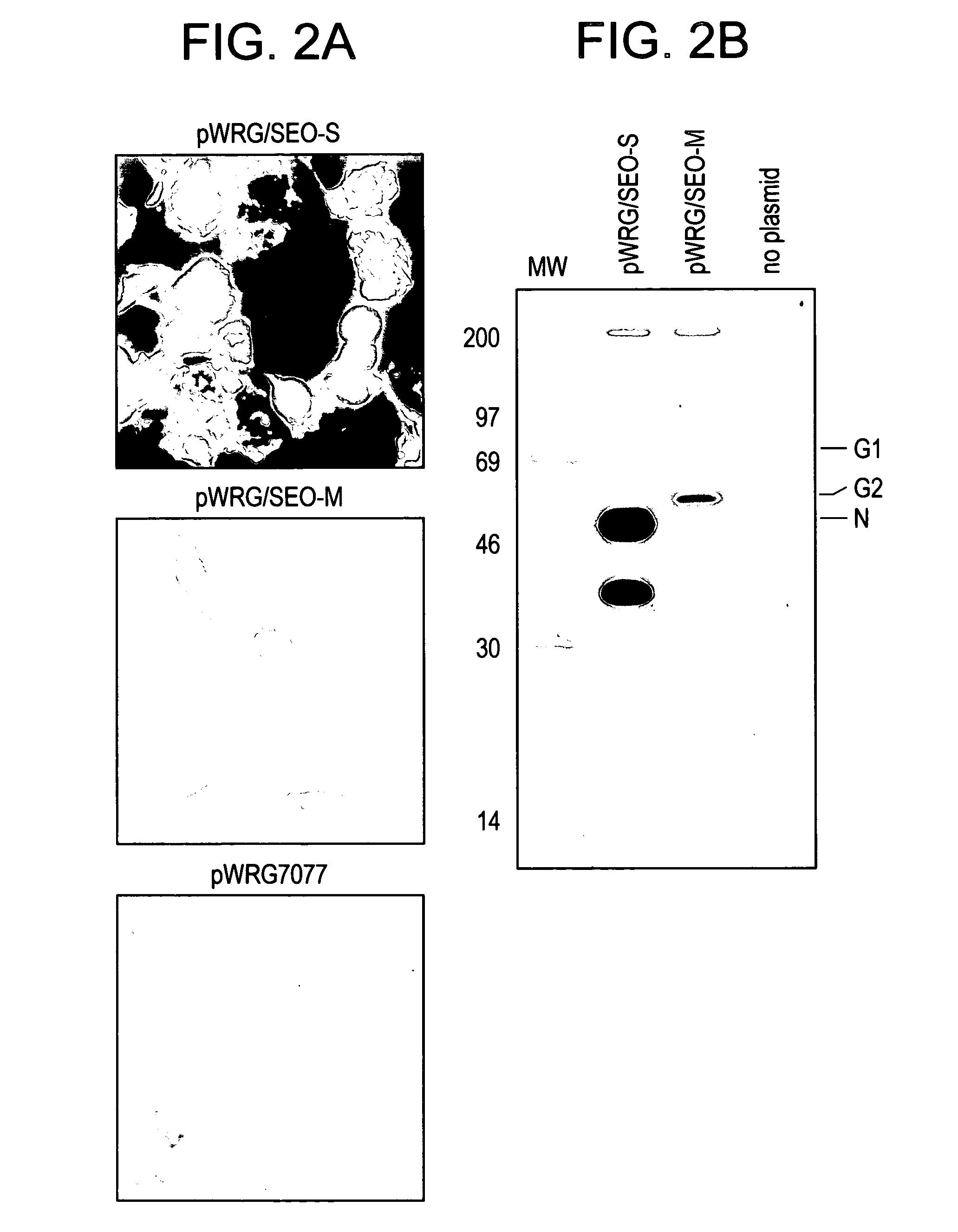 Extraneous DNA sequence that facilitates hantavirus gene expression