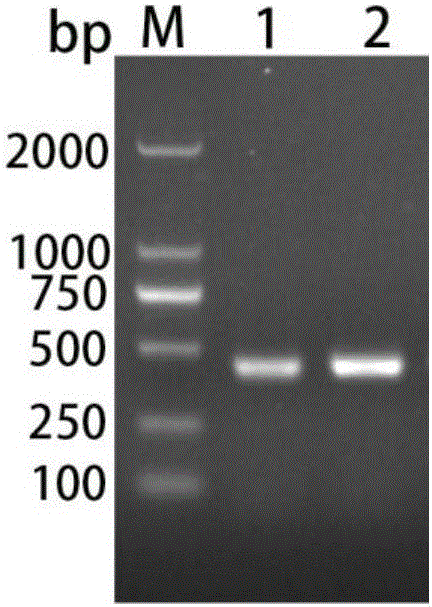 Cerebral echinococcosis marker nad5 gene, and detection method and kit of Taenia multiceps