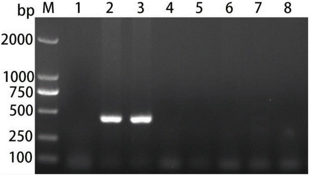 Cerebral echinococcosis marker nad5 gene, and detection method and kit of Taenia multiceps