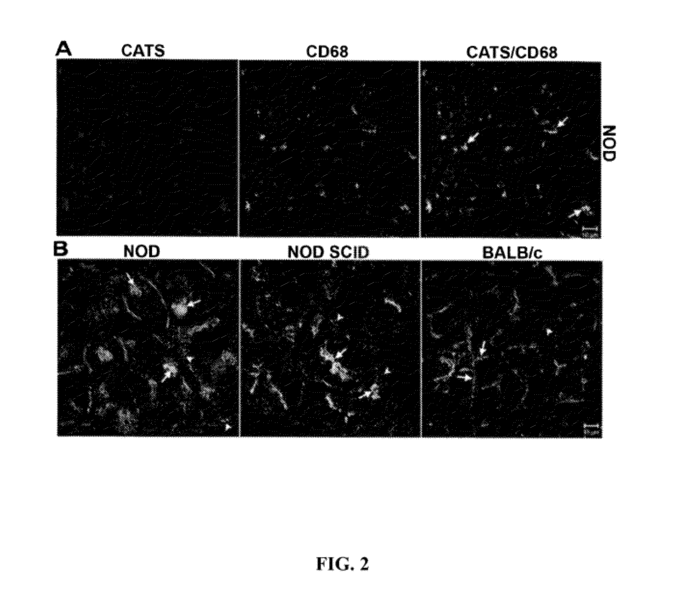 Biomarkers for the early detection of autoimmune diseases