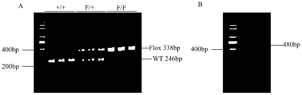 Application of ring finger protein Rnf20 gene