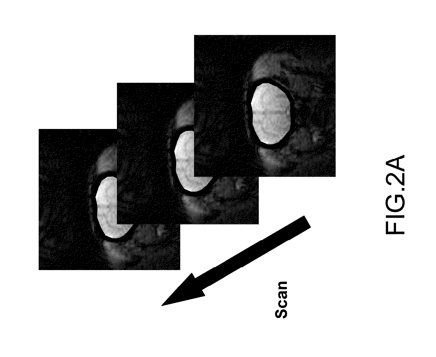 Using Heavy Water as a Contrast Agent for Hydrogen Magnetic Resonance Imaging