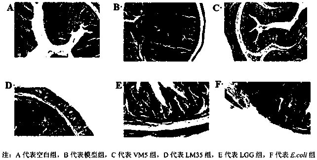 A kind of Lactococcus lactis lactic acid subspecies capable of regulating colon tumor signaling pathway and its use