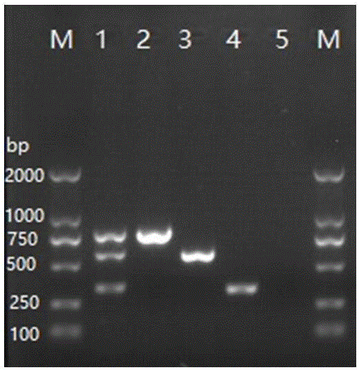 Detection primer set of Streptococcus agalactiae, detection kit and multiplex PCR detection method