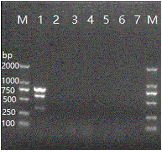 Detection primer set of Streptococcus agalactiae, detection kit and multiplex PCR detection method