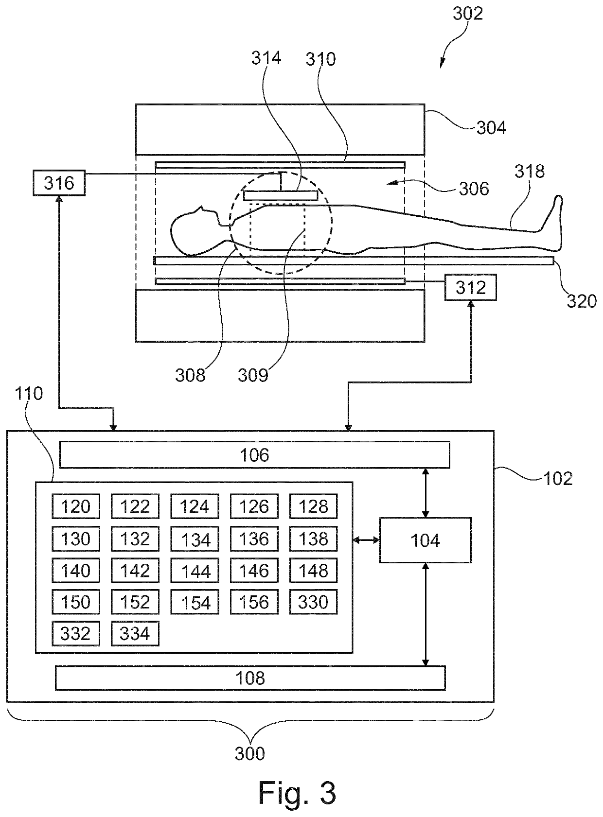 Single-point dixon method for fat-water separation in chemical exchange saturation transfer magnetic resonance imaging