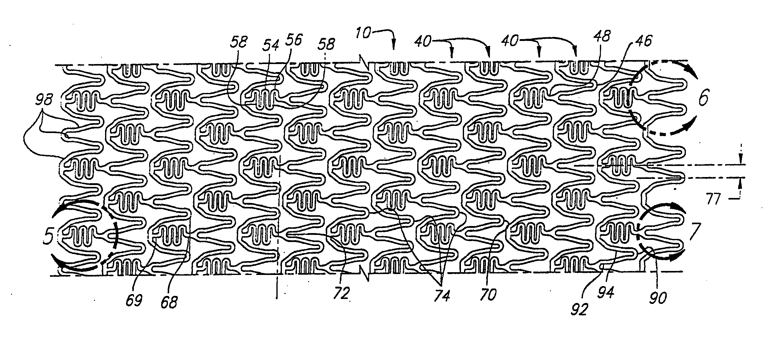 Intravascular stent