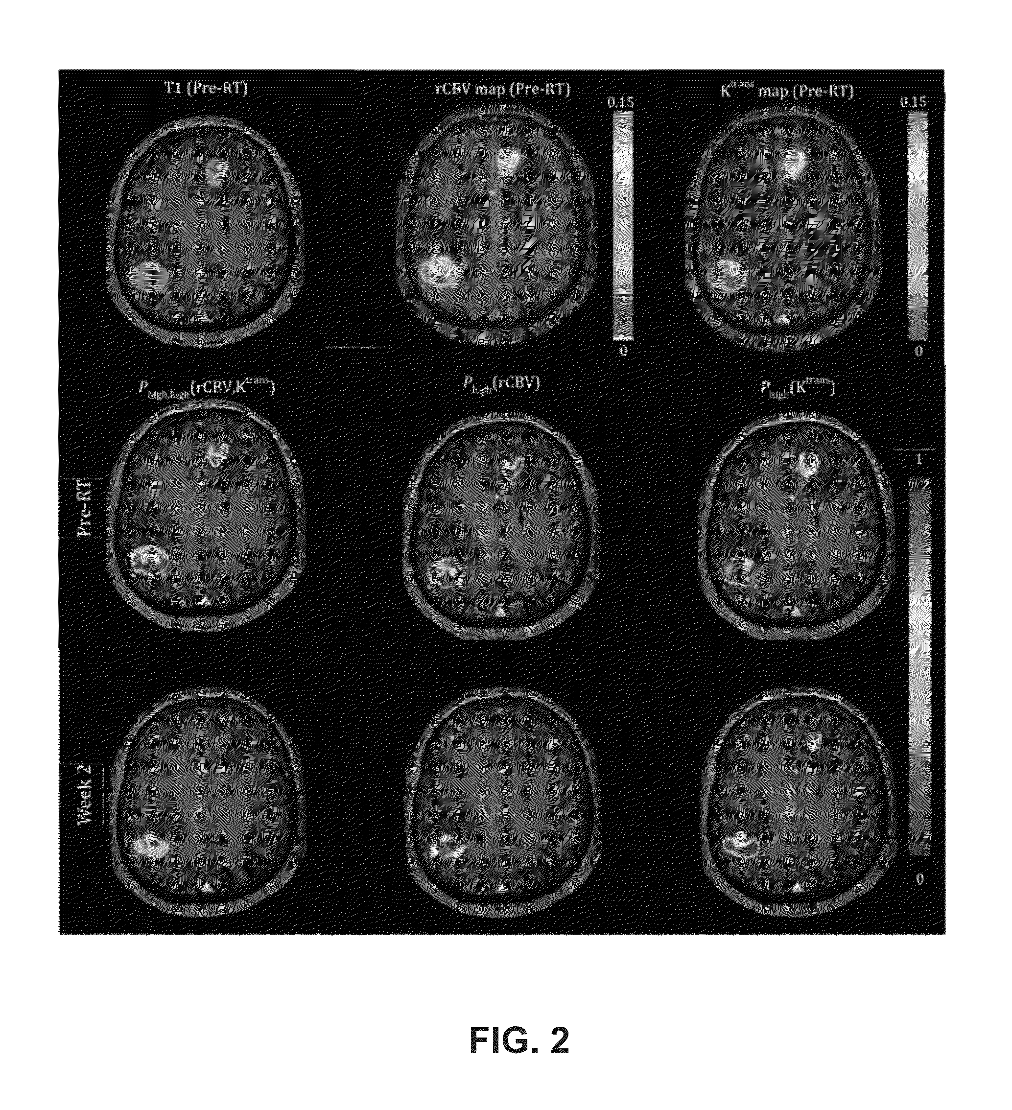 Subvolume identification for prediction of treatment outcome