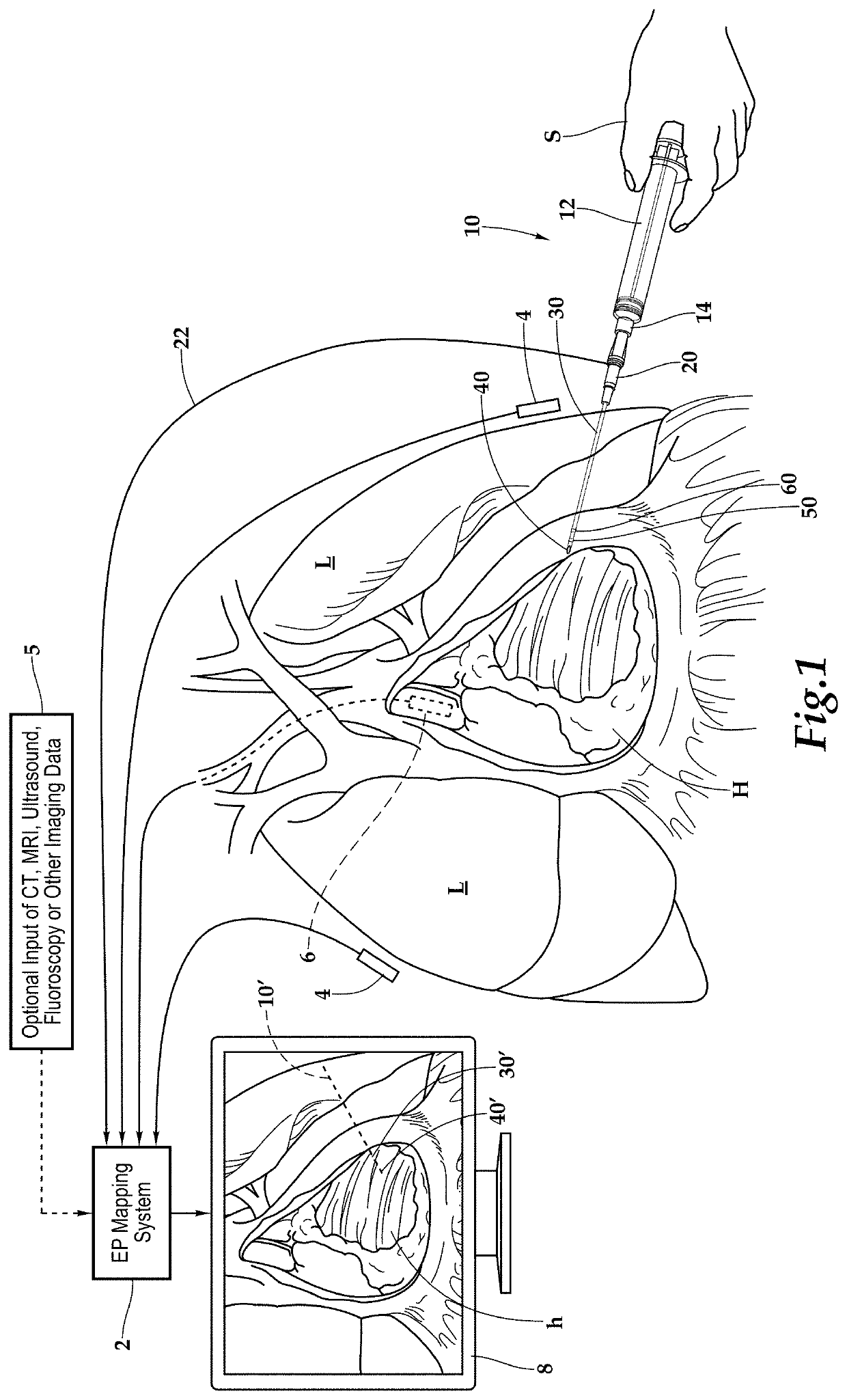 Intracardiac ultrasound catheter handheld adapter