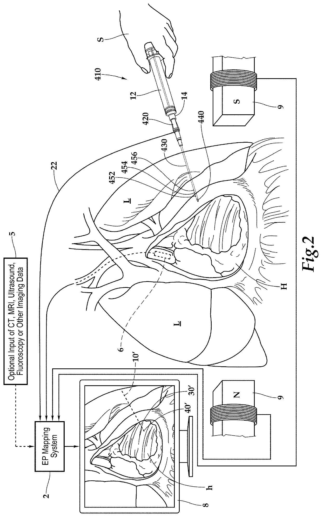 Intracardiac ultrasound catheter handheld adapter