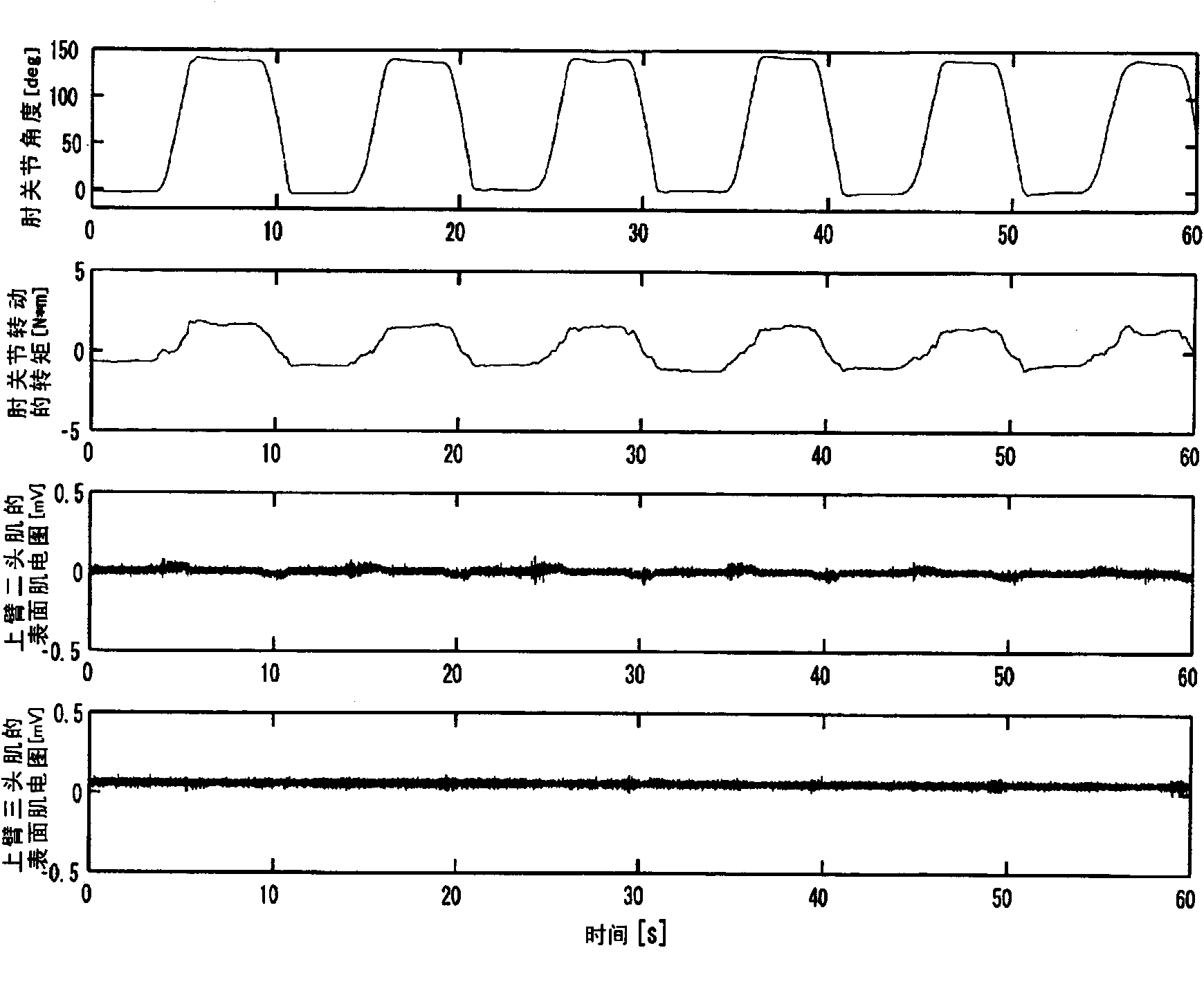 Muscle tone measuring apparatus