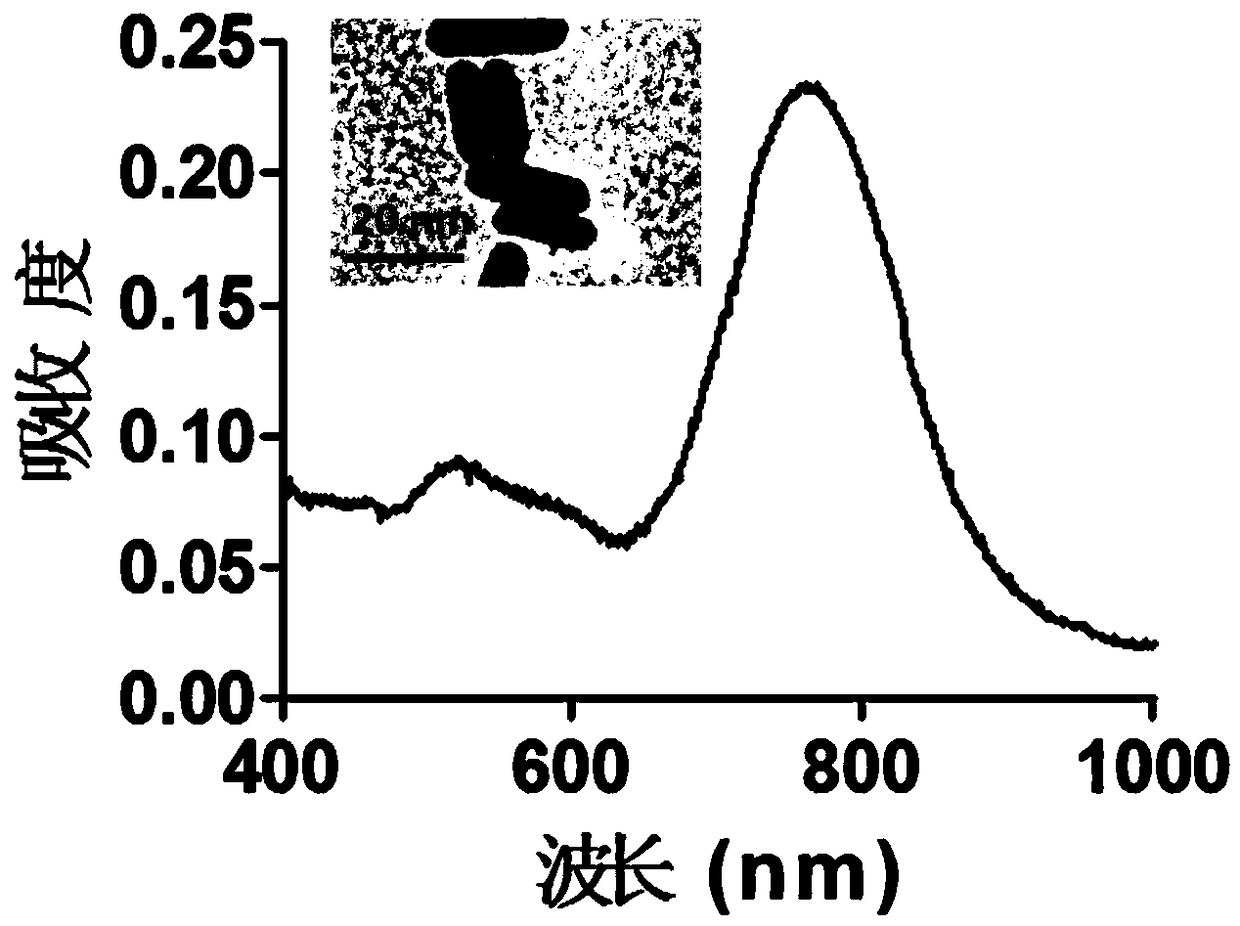 High molecular gel used for bladder irrigation targeting delivering of pharmacologically active substances to bladder cancer, and preparation method thereof