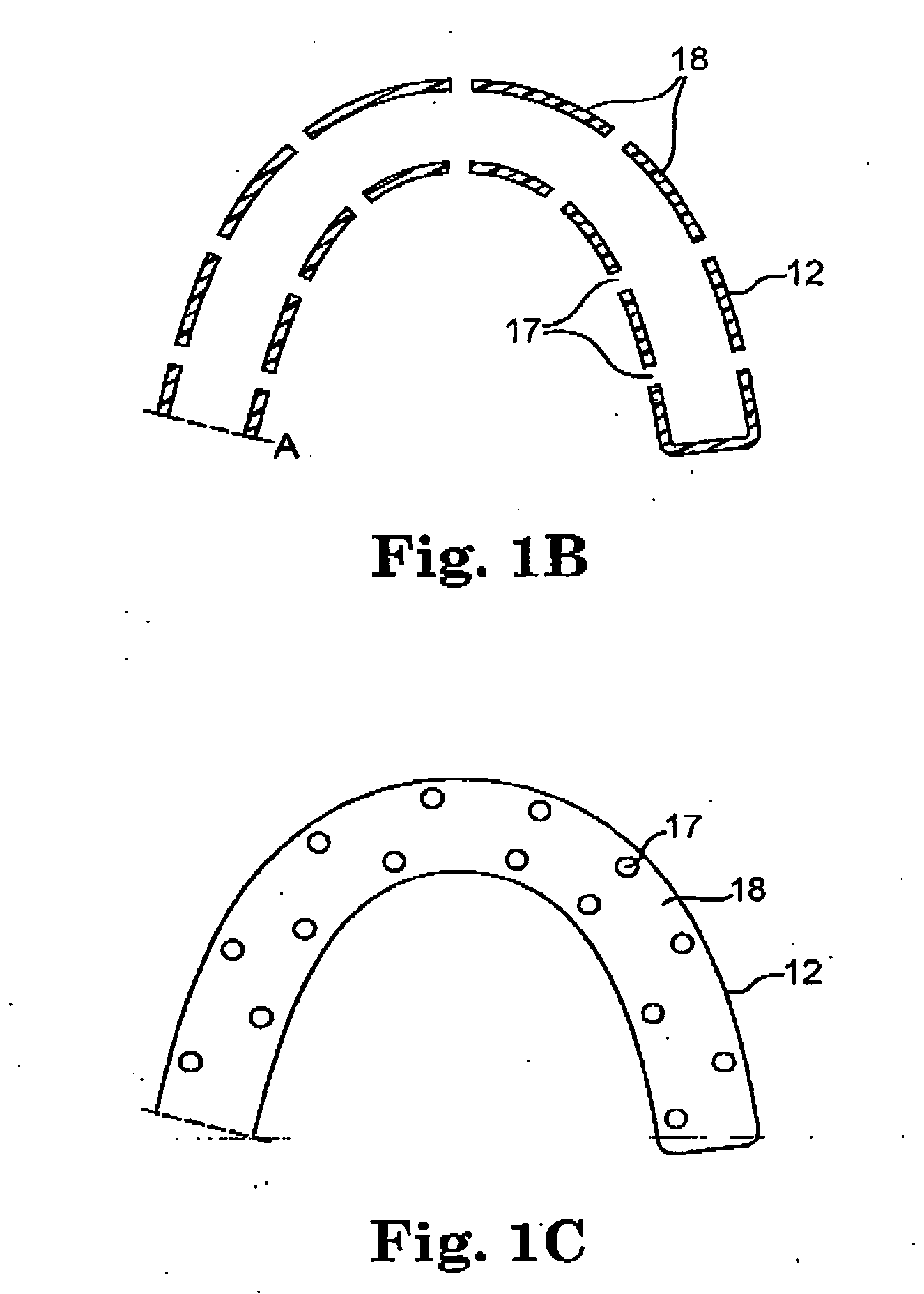 Cerebrospinal fluid shunt having long term Anti-occlusion agent delivery