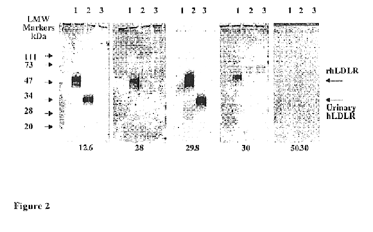 Monoclonal antibodies to the human LDL receptor, their production and use