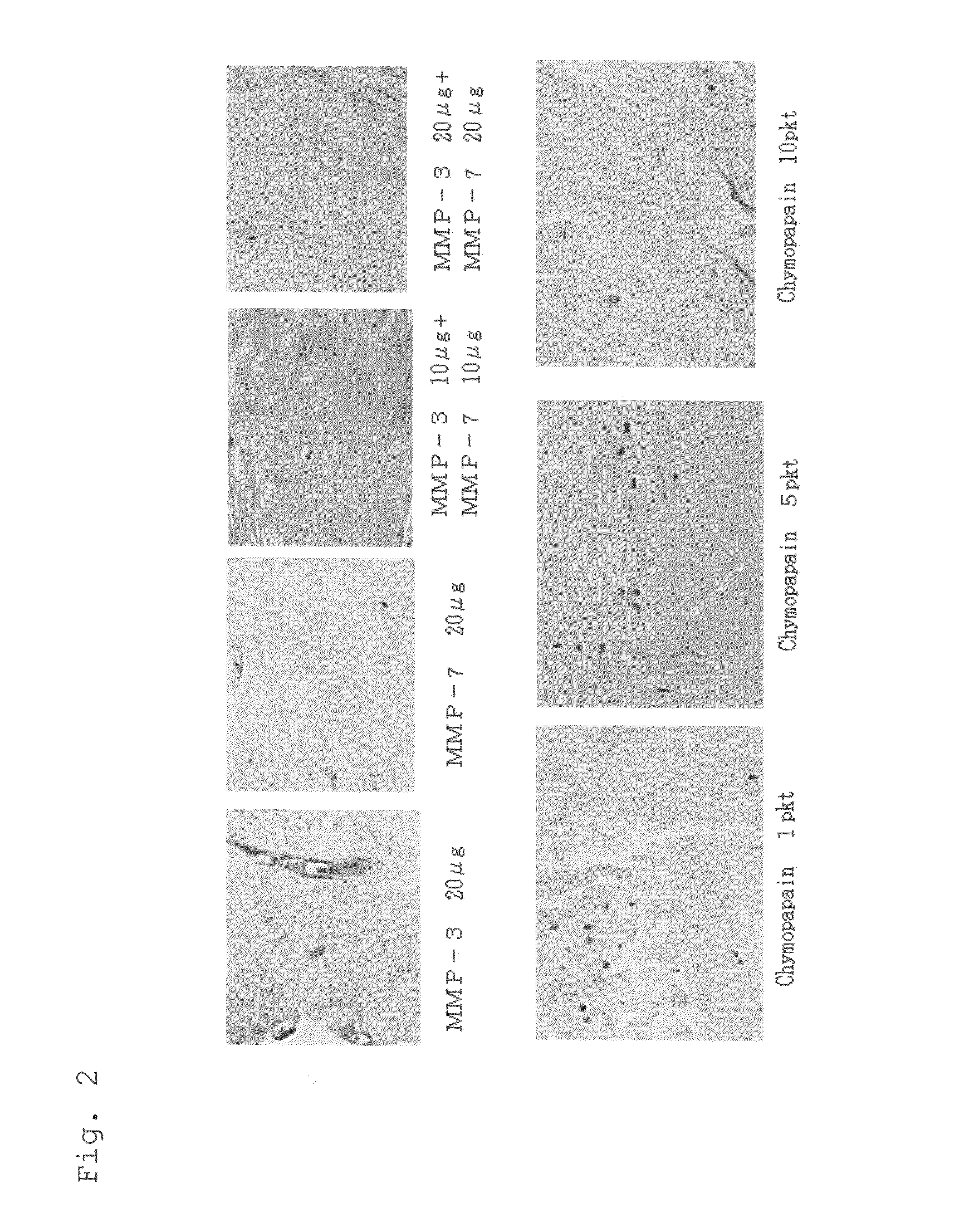 Method of therapy for degenerative intervertebral discs