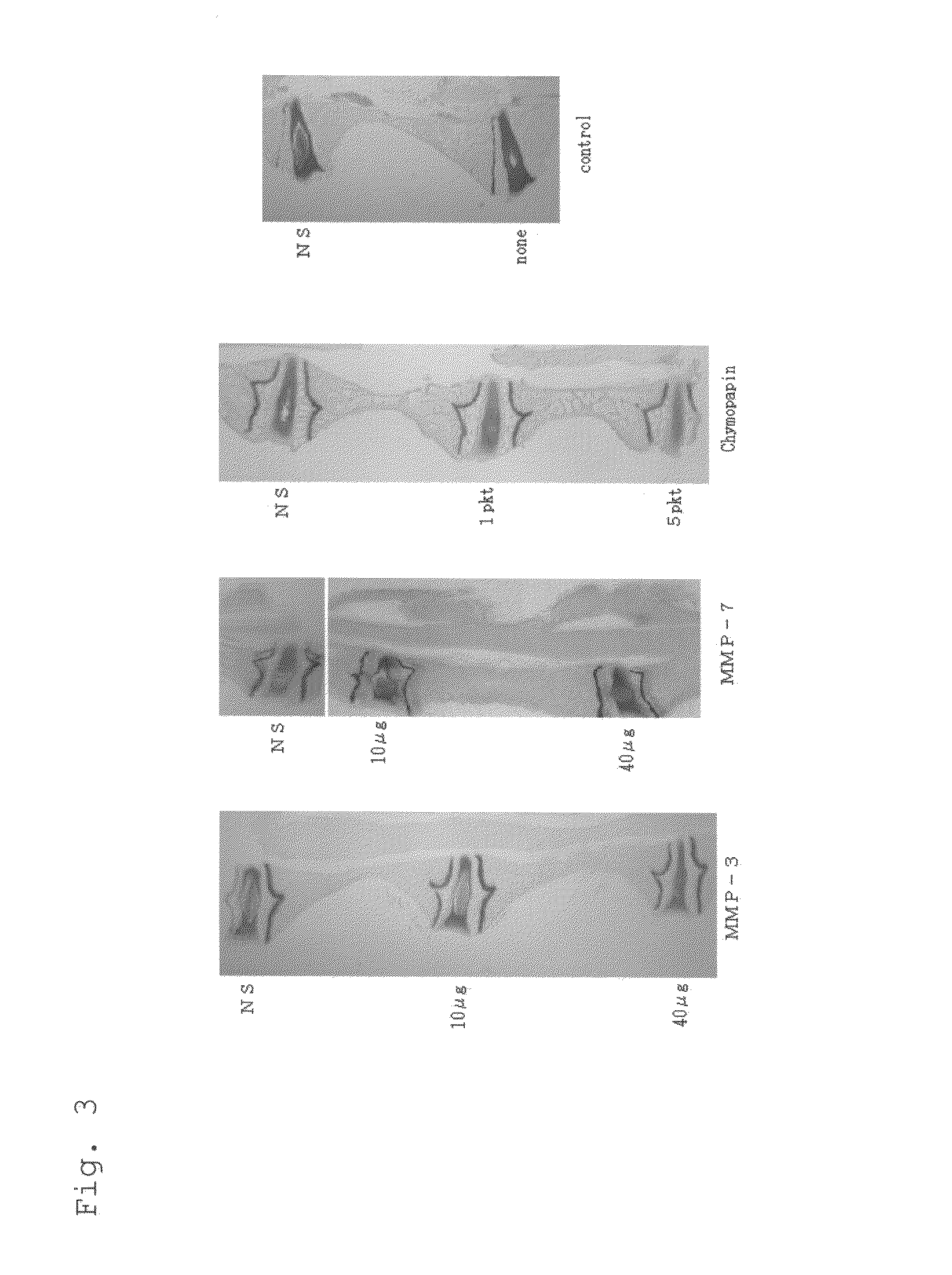 Method of therapy for degenerative intervertebral discs