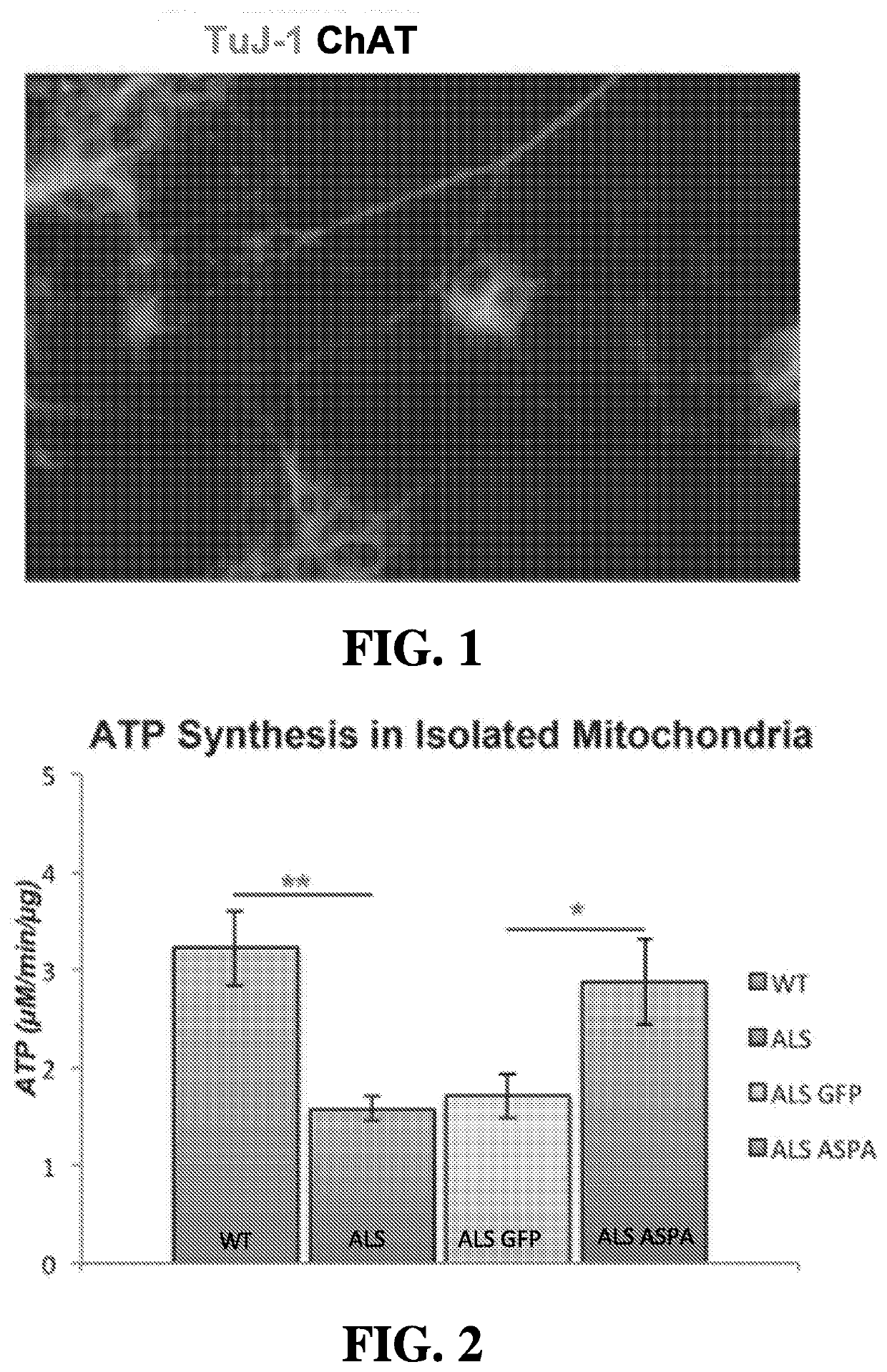 Methods of Treating or Preventing Amyotrophic Lateral Sclerosis