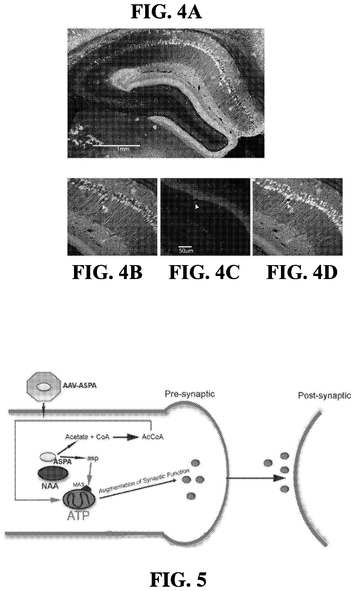 Methods of Treating or Preventing Amyotrophic Lateral Sclerosis