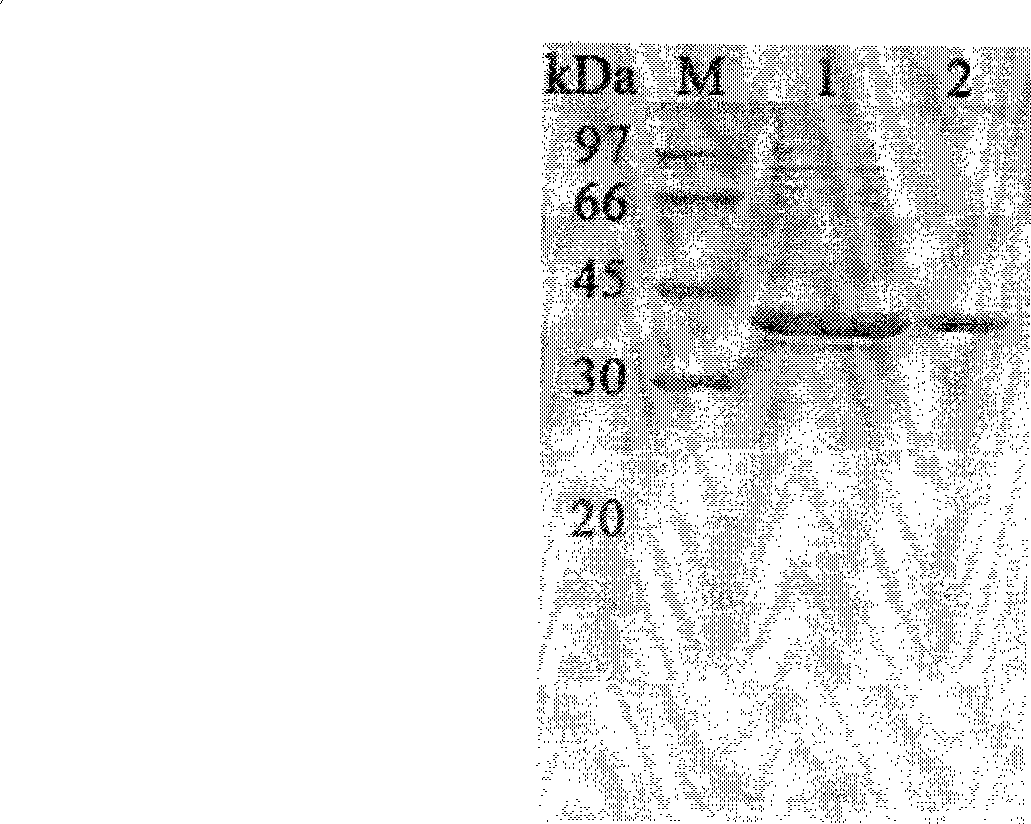 Neutral phytase PHYMJ11 and gene and application thereof