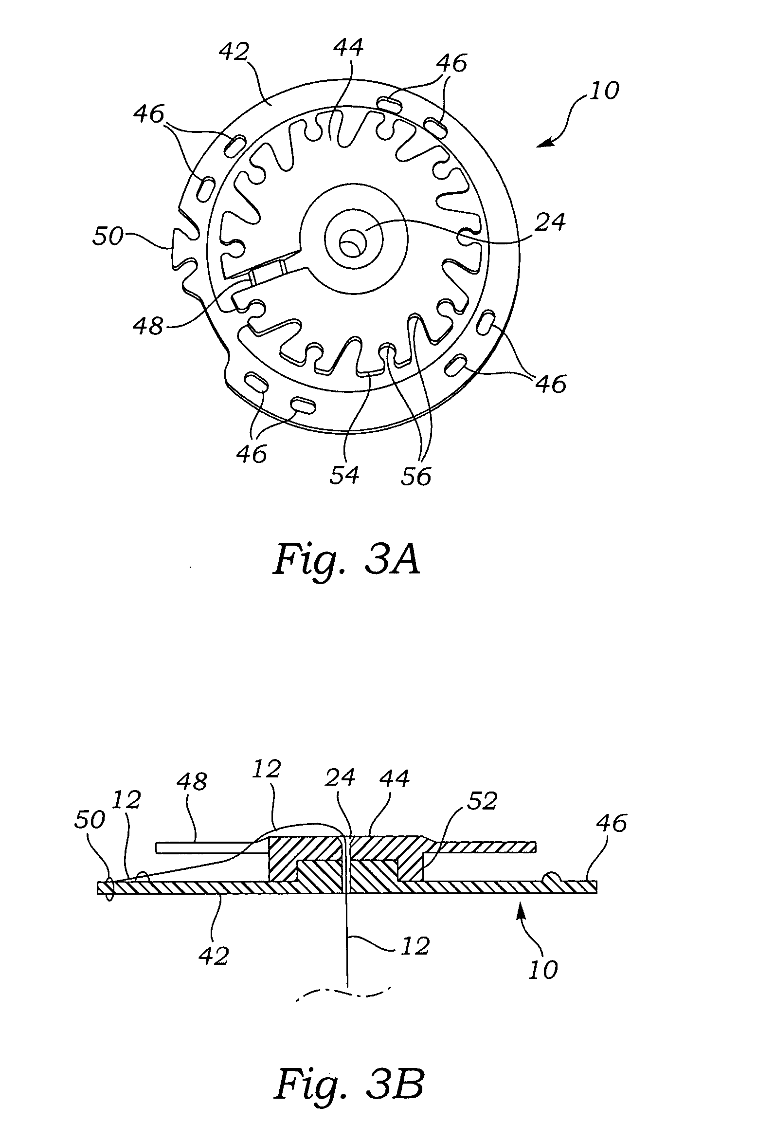 Apparatus, system, and method for applying and adjusting a tensioning element to a hollow body organ