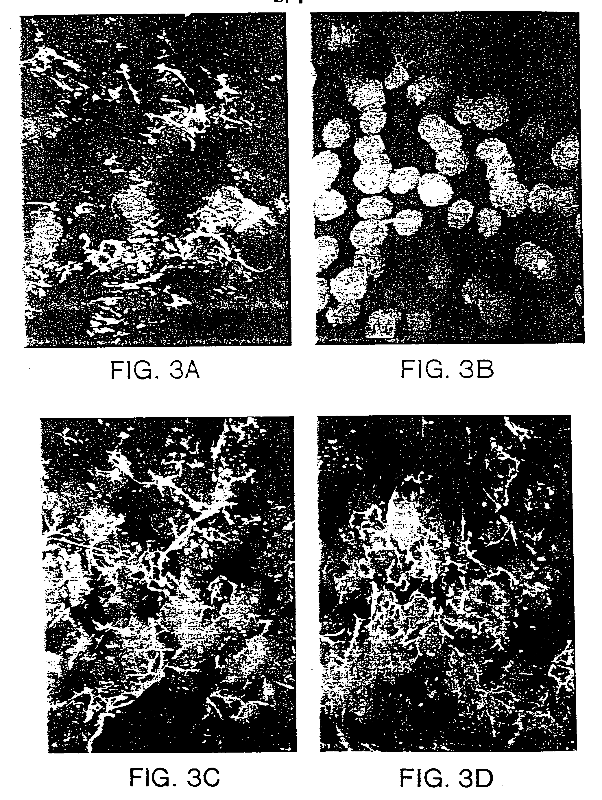 Delivery construct for antisense nucleic acids and methods of use