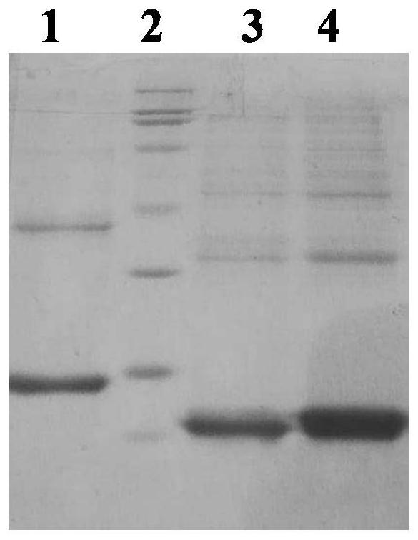 Monoclonal antibody for resisting hepatitis B virus e antigen and application thereof