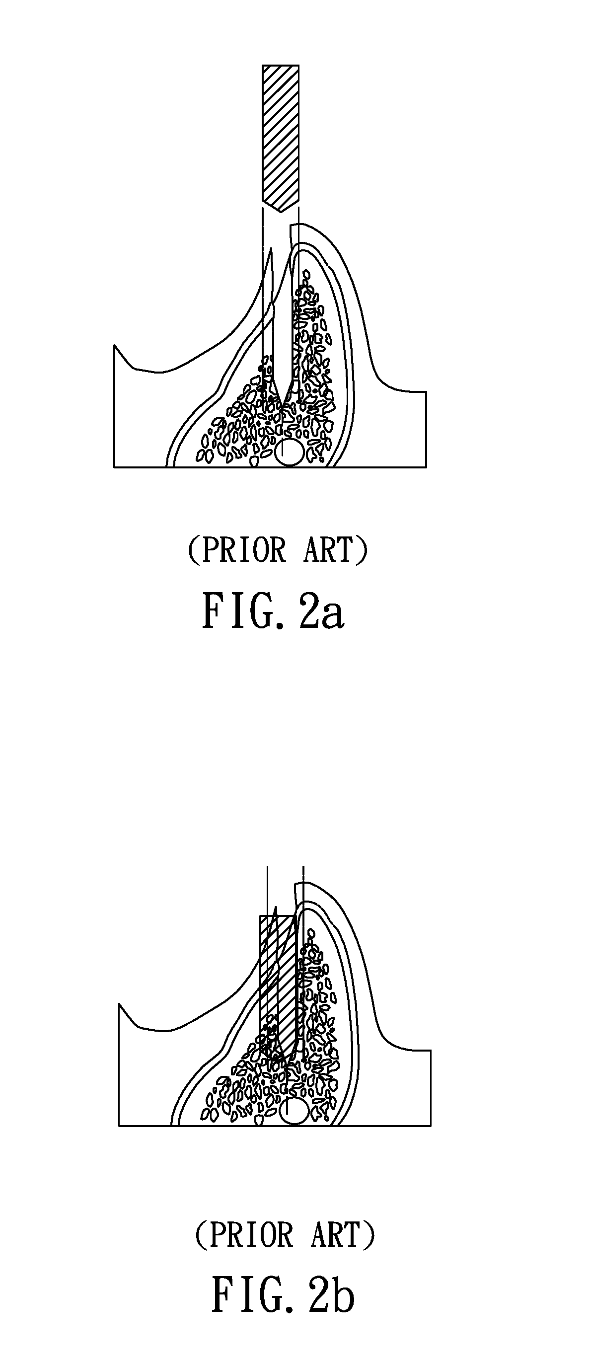 Planning and guiding method and excavation guiding device for correctly implanting artificial tooth root at predetermined site