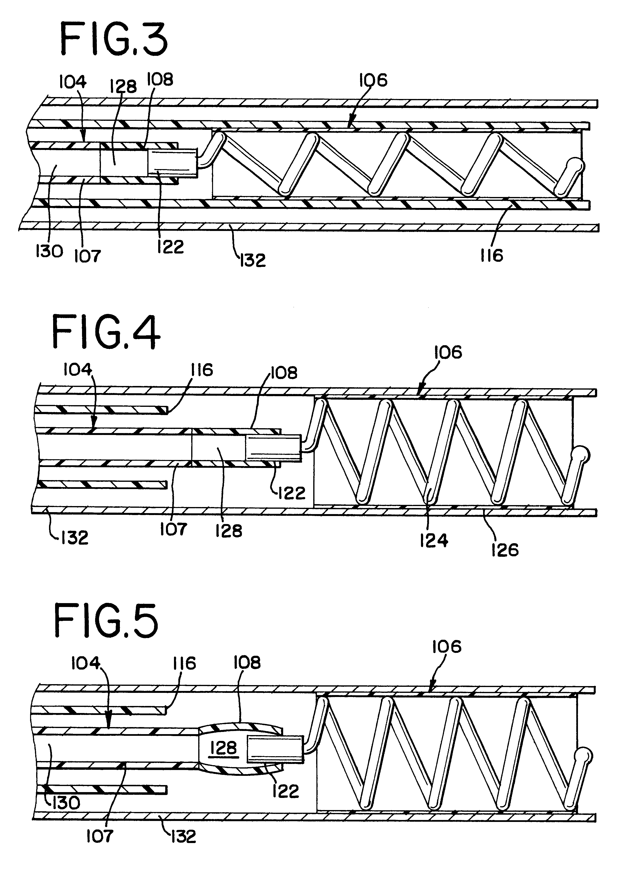 Hydraulic stent deployment system