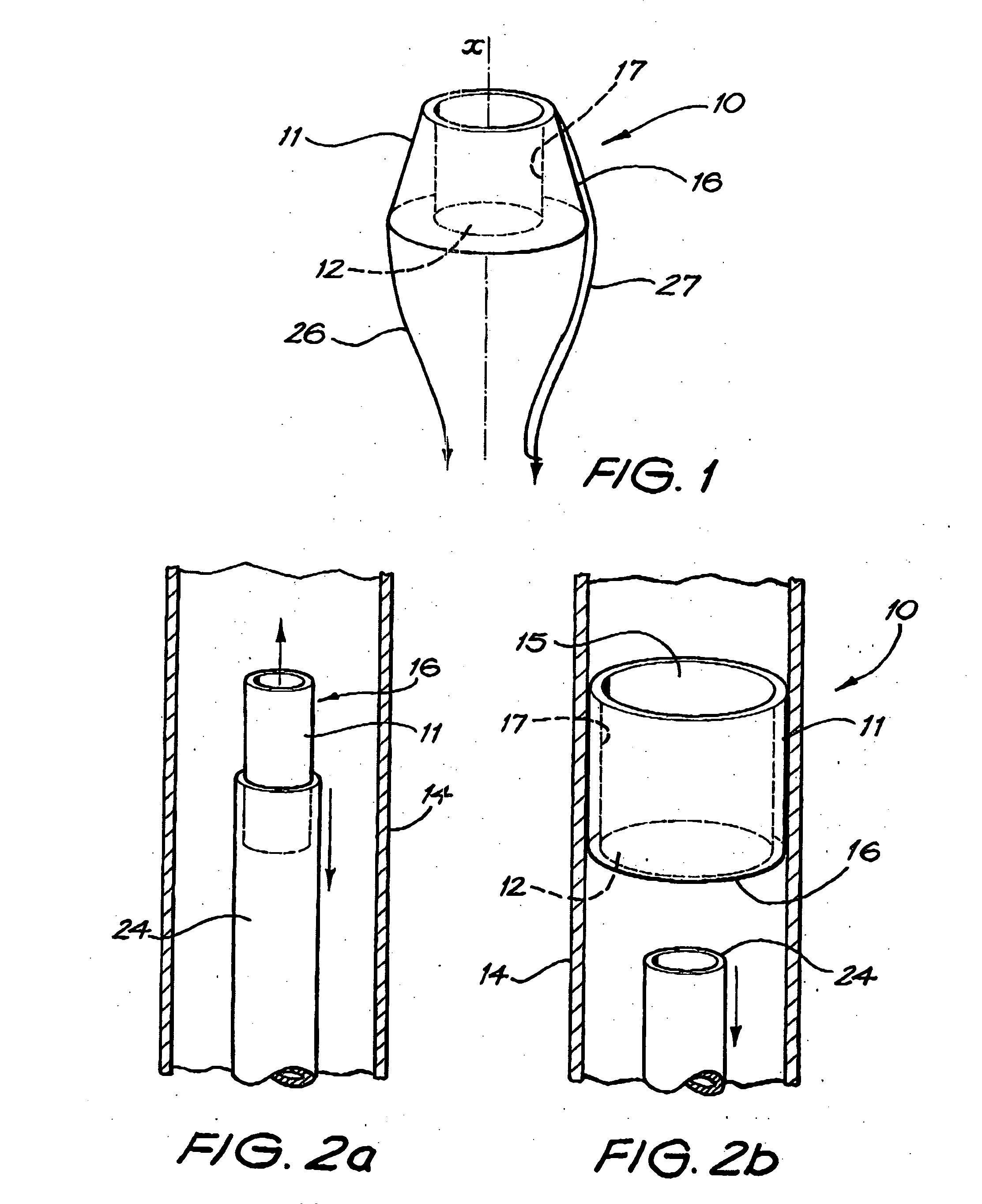 Device for use in intraluminal grafting