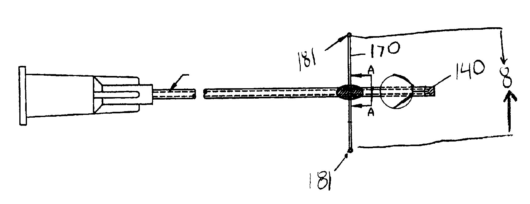 Sinus valved glaucoma shunt