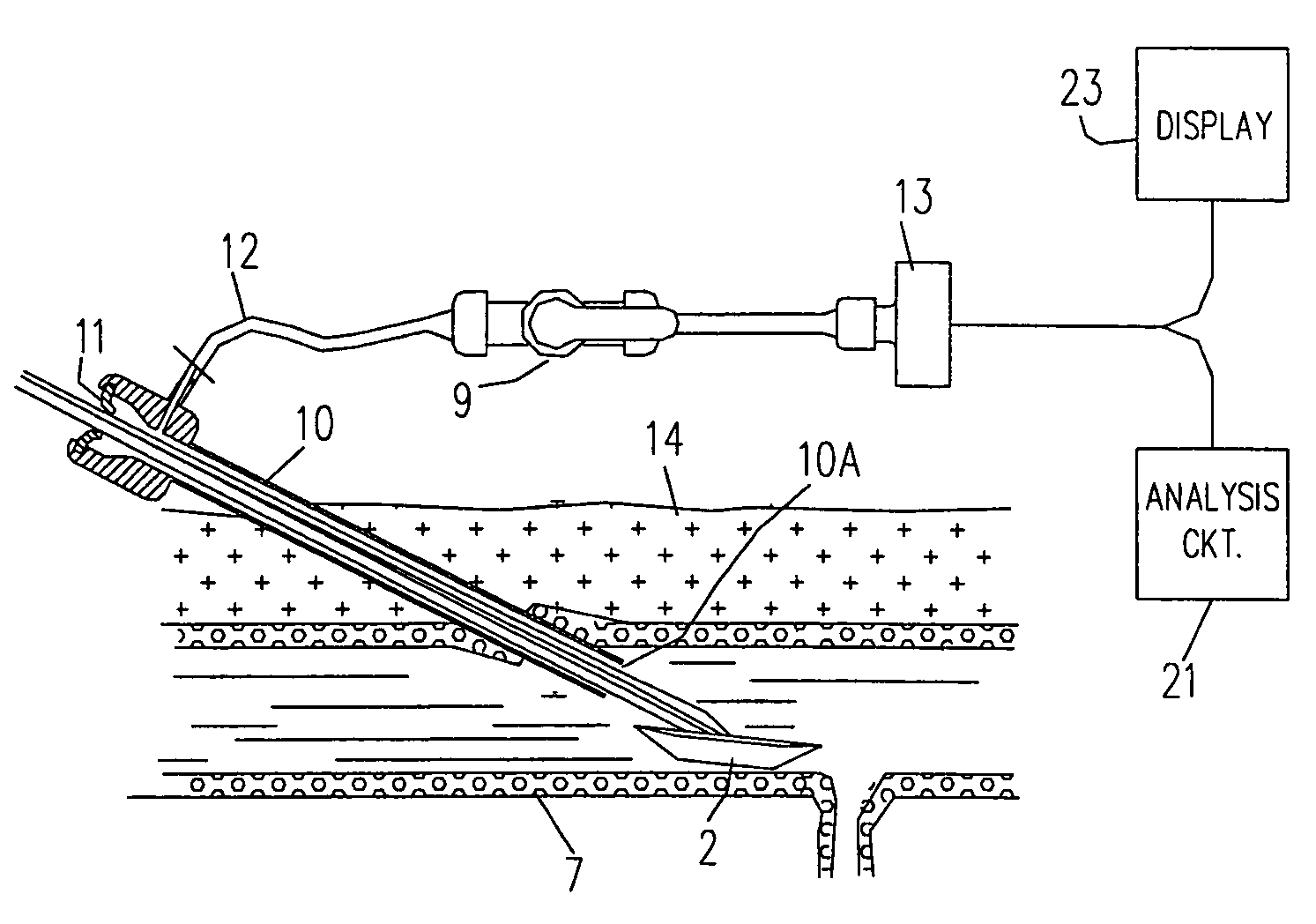 Technique to confirm correct positioning of arterial wall sealing device