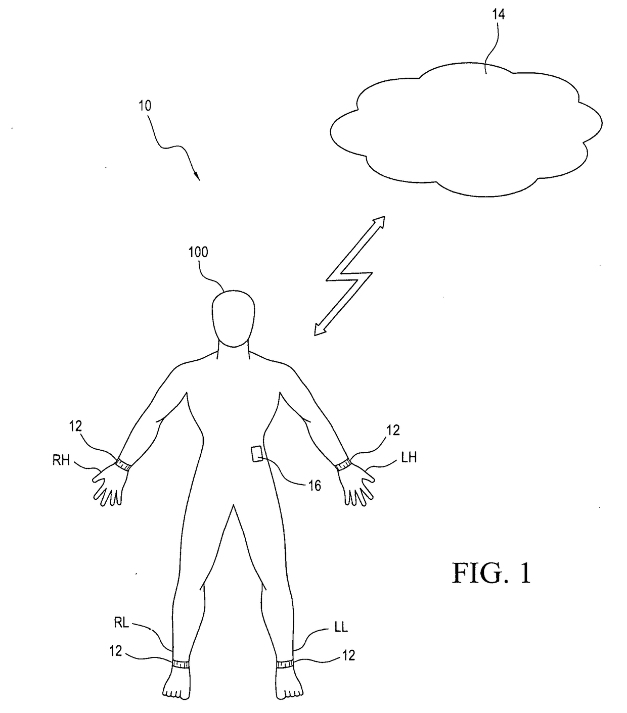 System and method for diagnosing and notification regarding the onset of a stroke