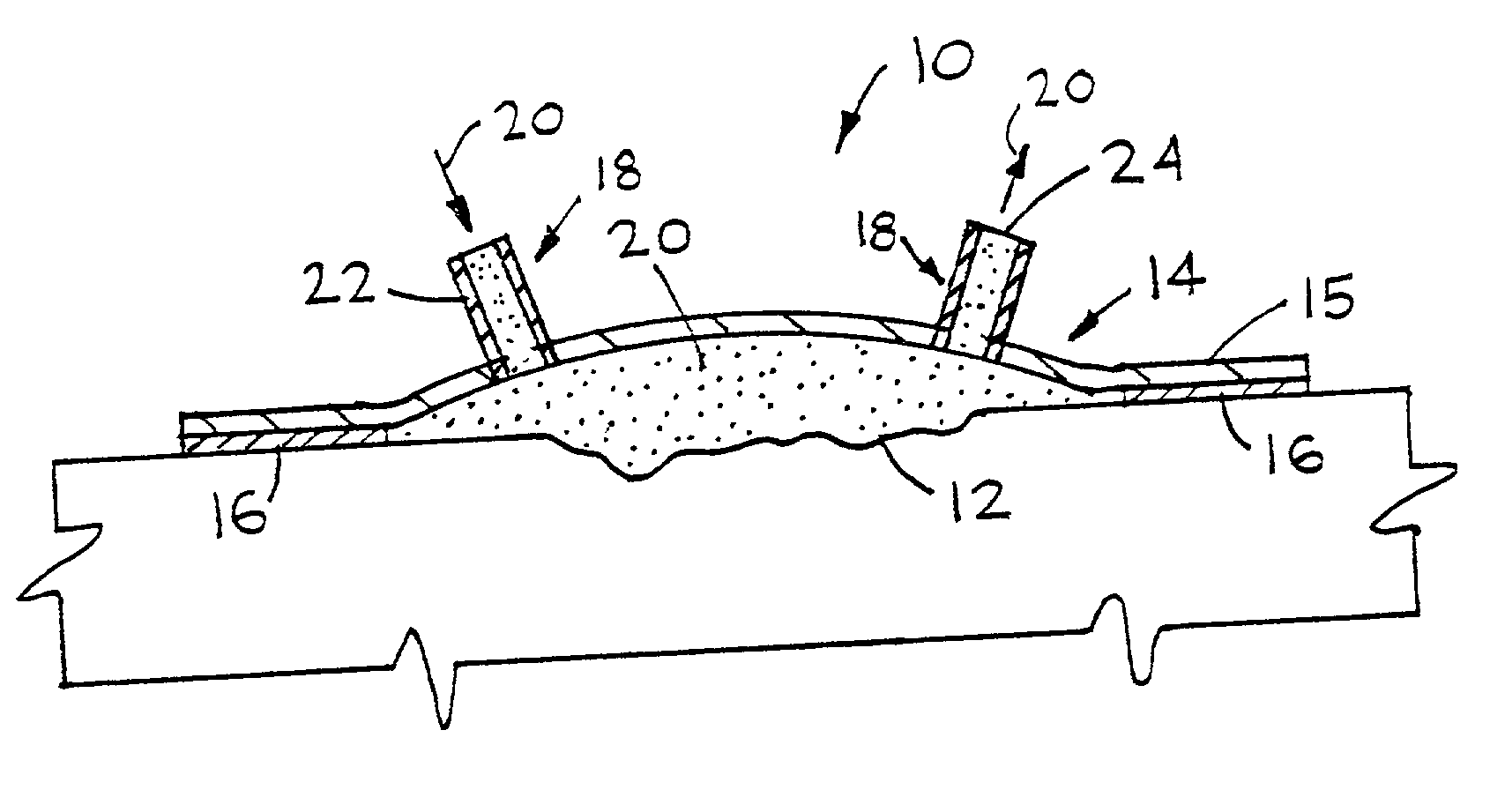 Device for treating and promoting healing of damaged body tissue