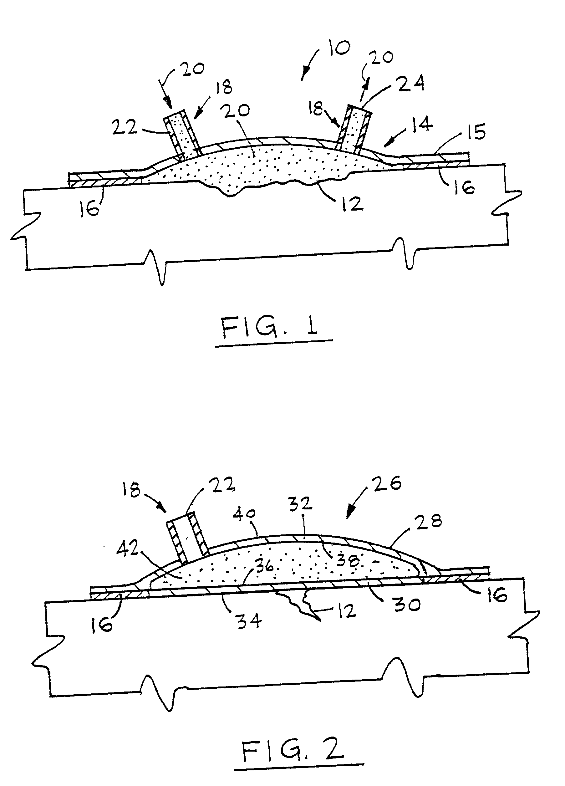 Device for treating and promoting healing of damaged body tissue